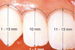 comprimento coroa anatomica