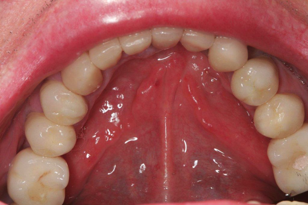 estetica-tratamentos-dentarios