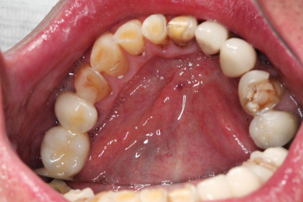 procedimentos-esteticos-odontologicos-4