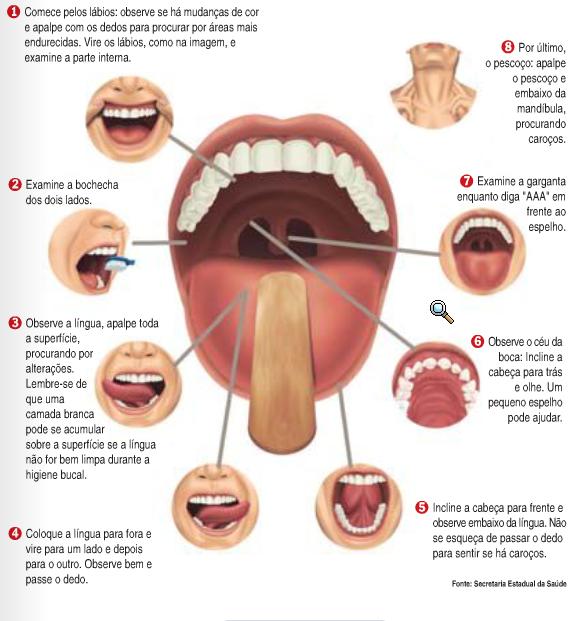 auto-exame-bucal